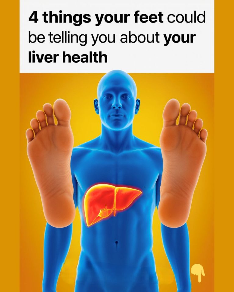 4 Things Your Feet Could Be Telling You About Your Liver Health