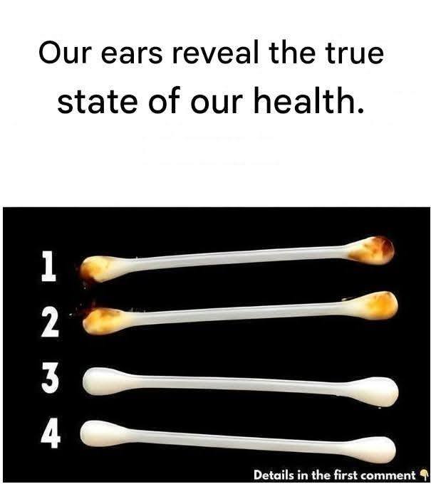 The human body never ceases to amaze us with its functioning. It is in fact able to send signals to alert us of a condition or problem through the various organs and areas that compose it. Furthermore, did you know that our ears can tell us a lot about our health?