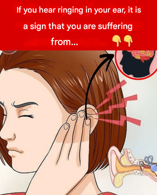 If you hear ringing in your ear, it may be a sign that you are suffering from…