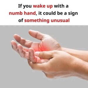 Waking Up with a Numb Hand: What It Could Mean