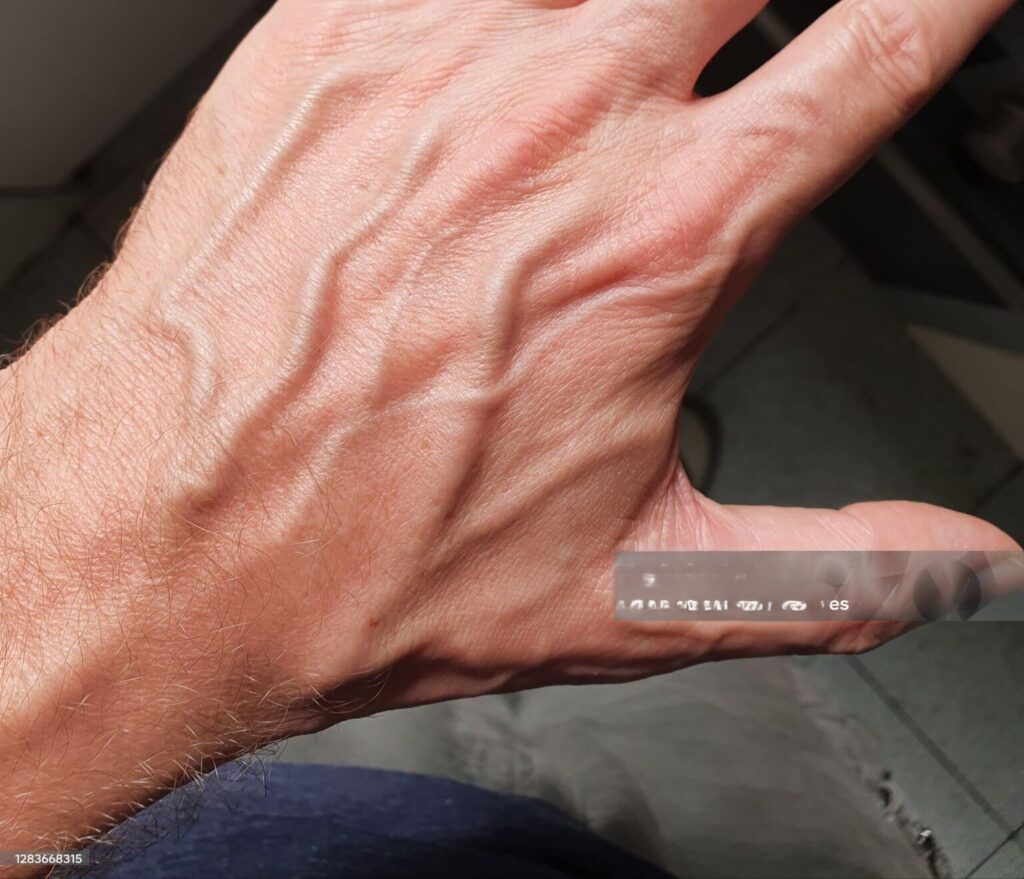 If you have visible veins, it means you are…