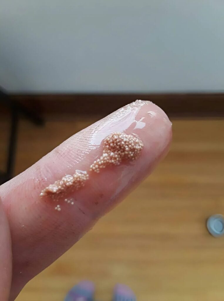 I found small slippery lumps in an egg and thought they were insect eggs, but then I discovered a horrible truth